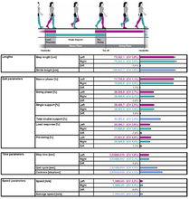 Load image into Gallery viewer, OptoGait Gait Analysis System - Modular System
