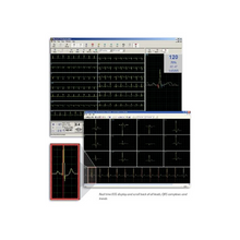 Load image into Gallery viewer, COSMED Quark C12x Stress &amp; Resting ECG Monitor
