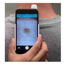 Load image into Gallery viewer, DermLite HUD Home Use Smart Photo Dermatoscope
