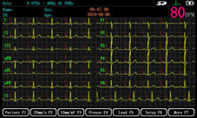 Load image into Gallery viewer, ECGMAC EM-1201 Digital 12 Channel ECG Machine
