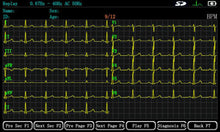 Load image into Gallery viewer, ECGMAC EM-1201 Digital 12 Channel ECG Machine
