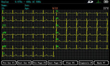 Load image into Gallery viewer, ECGMAC EM-1201 Digital 12 Channel ECG Machine
