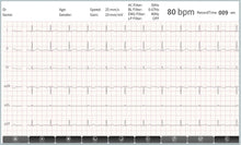 Load image into Gallery viewer, ECGMAC PE-1202 PC Based ECG Machine With Software &amp; Bluetooth
