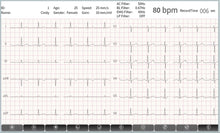 Load image into Gallery viewer, ECGMAC PE-1202 PC Based ECG Machine With Software &amp; Bluetooth
