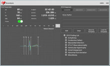 Load image into Gallery viewer, ECGMAC PE-1202 PC Based ECG Machine With Software &amp; Bluetooth
