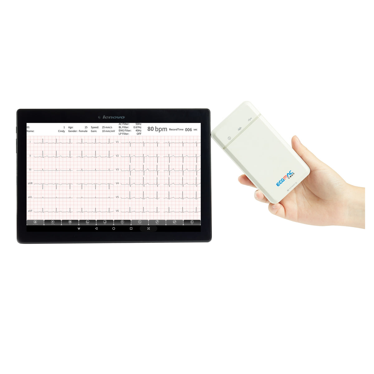 ECGMAC PE-1202 PC Based ECG Machine With Software & Bluetooth – HMGDirect