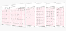 Load image into Gallery viewer, ECGMAC PE-1202 PC Based ECG Machine With Software &amp; Bluetooth
