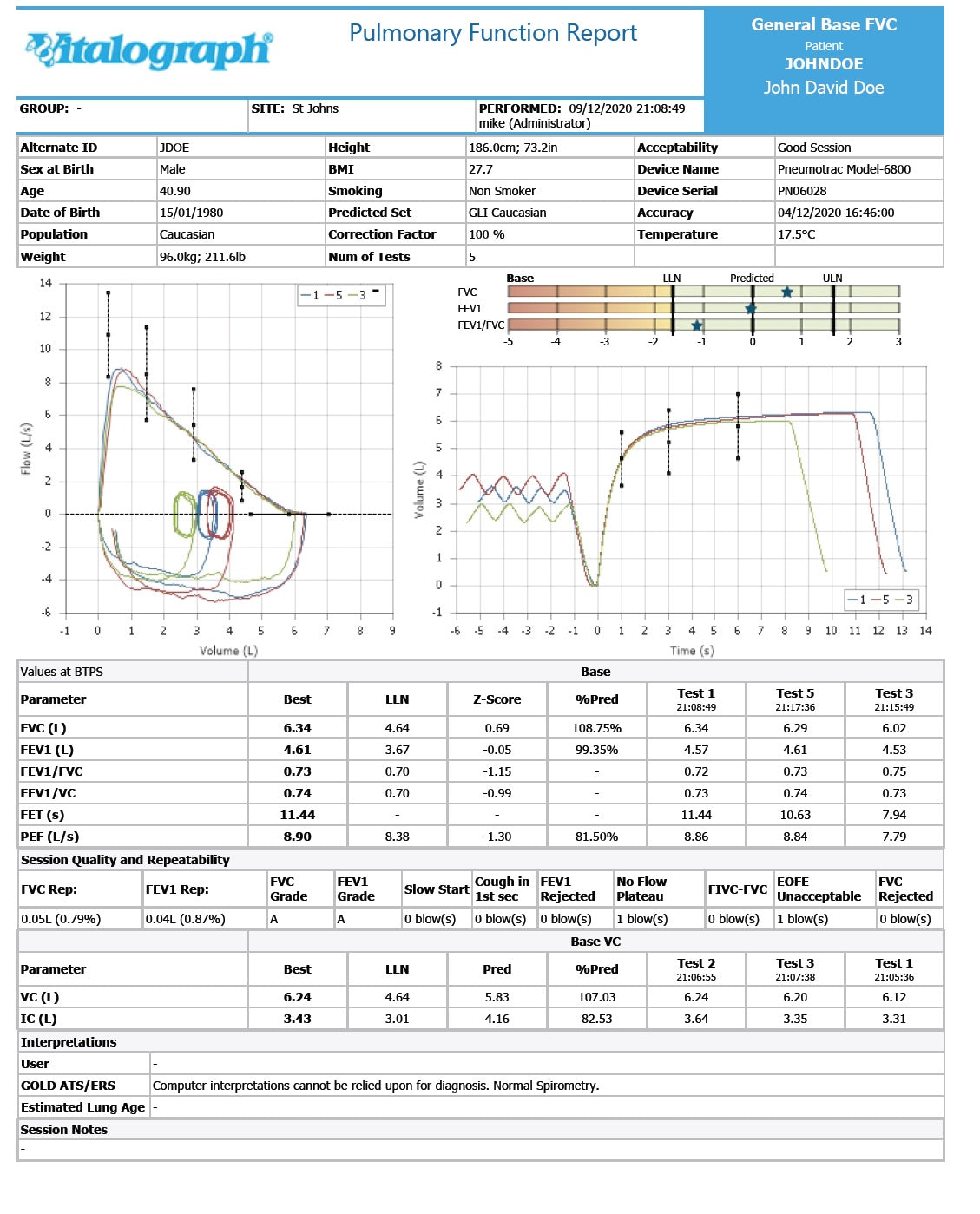 Spirometry Report.pdf Vitalograph Pneumotrac PC Spirometer With Spirotrac 6 Software – HMGDirect