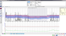 Load image into Gallery viewer, Spacelabs Ontrak 24 Hour Ambulatory Blood Pressure Monitor
