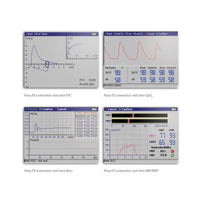 Load image into Gallery viewer, COSMED Pony FX Desktop Spirometer With Inbuilt Printer &amp; Software
