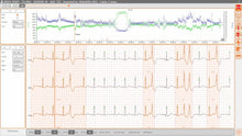 Load image into Gallery viewer, Cardioline Click Holter ECG Monitor (24/48Hour &amp; 7 Day Monitoring)
