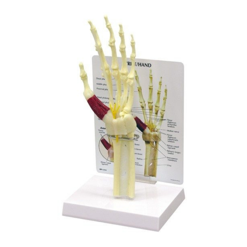 Hand & Wrist Carpal Tunnel Life Size Anatomical Model