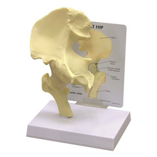 Load image into Gallery viewer, Hip Joint Life Size Anatomical Model
