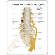 Load image into Gallery viewer, Vertebrae Life Size Anatomical Model With Sacrum
